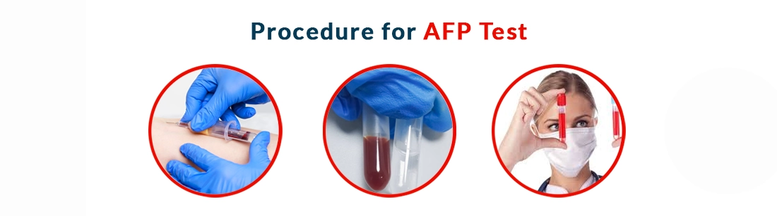 Procedure for AFP Test